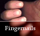 Fingernails issues